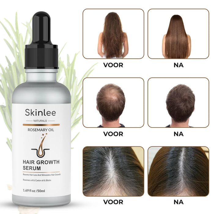 Skinlee Haargroei Serum 50 ml