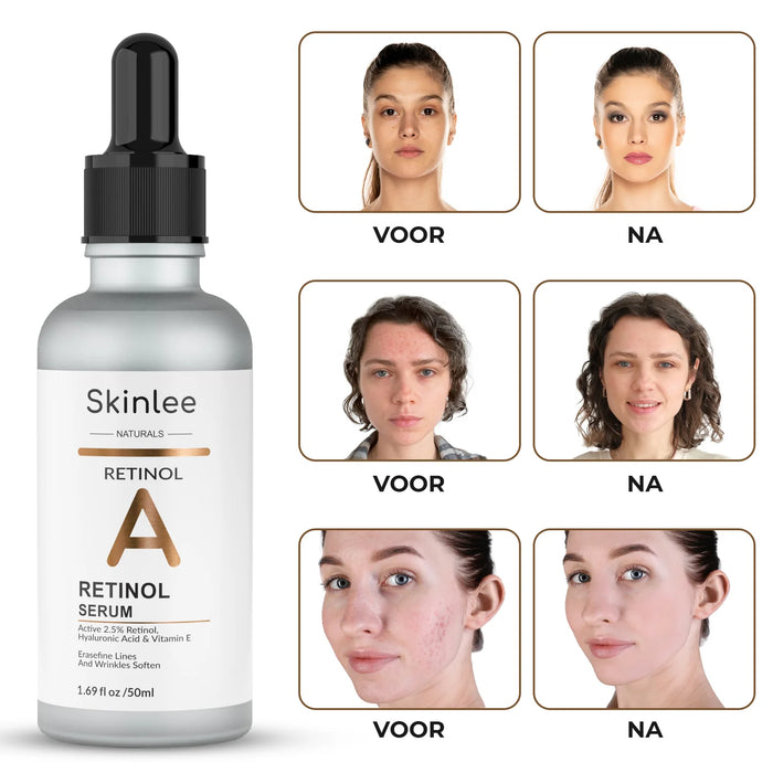 Skinlee Retinol Serum 50 ml
