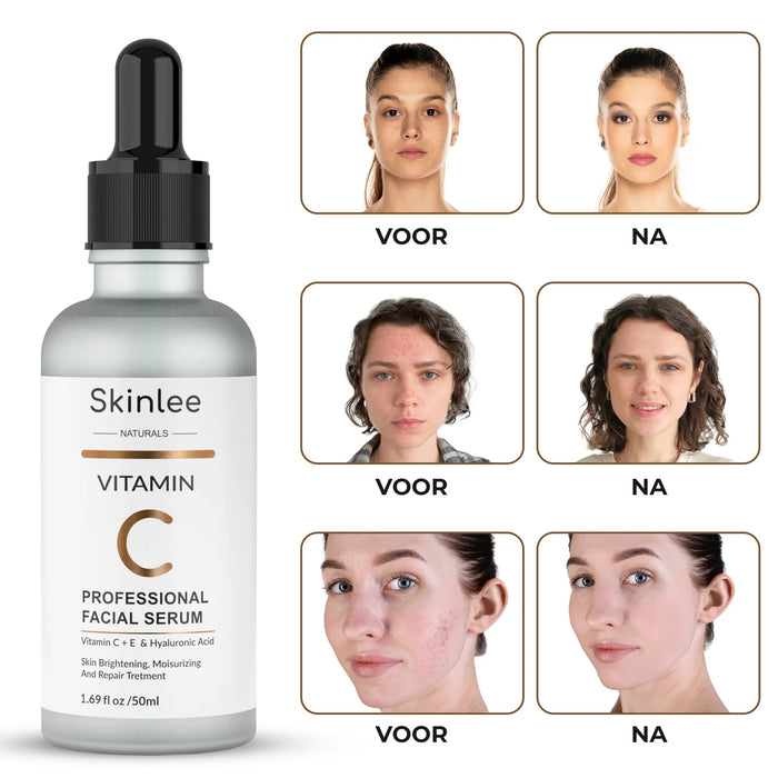 Skinlee Vitamine C Serum 50 ml