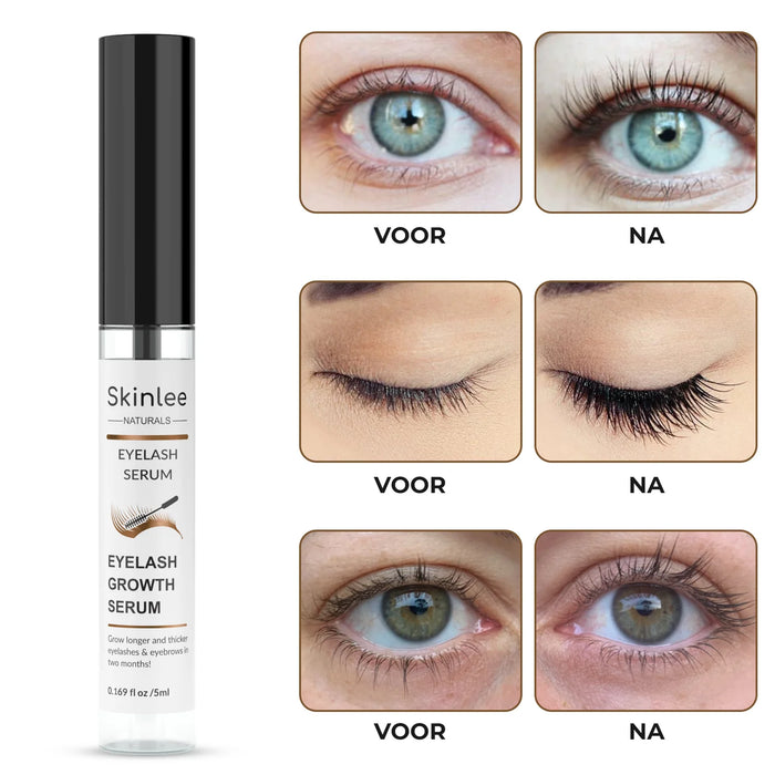 Skinlee Wimper Serum 5 ml